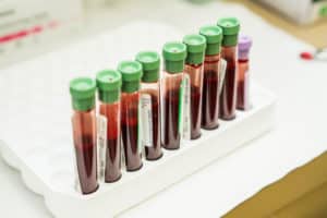 ck_BHclinic-74 Biomarker Research